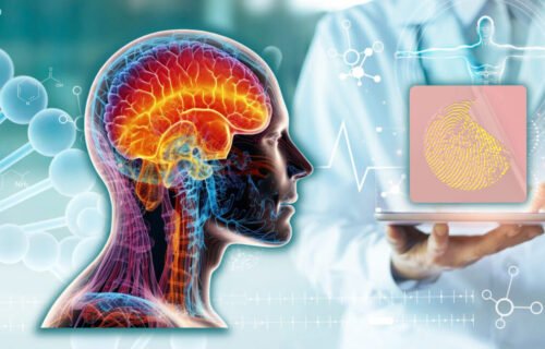 Neuroobliži so placebo!?